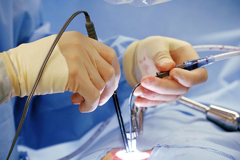 Keyhole Surgery, Laparoscopy or Minimally Invasive Surgery