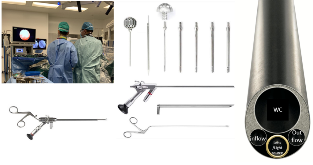 Figure 1a: using endoscope an visualize the surgery in a TV output system. 1b-d: Various endoscopic equipment which fits the working channel.