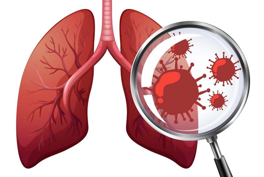 Respiratory Medicine